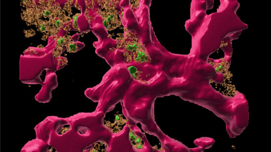 Plasmazellen (grün) liegen umgeben von Bindegewebszellen gut geschützt in ihren Überlebensnischen im Knochenmark.